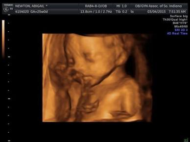 11021262_10101941588039212_9208456621533258054_n